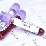 Cystatin C را بیشتر بشناسیم.